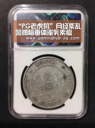 “PG老虎机”月经紊乱警惕脑垂体泌乳素瘤(图2) PG官网